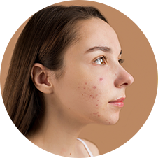 Servicios Dermatología Farmacia Santo Domingo Soria